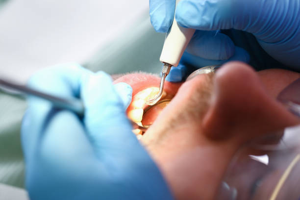 Best Emergency Pediatric Dental Care in Beulah, ND