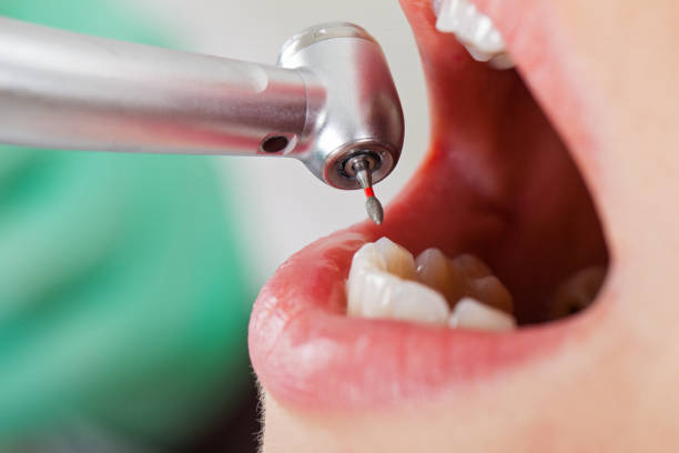 Best Emergency Treatment for Jaw Pain or Injury in Beulah, ND